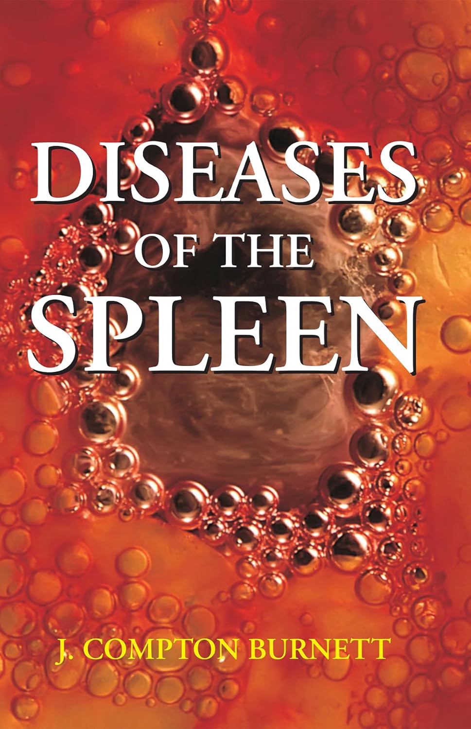 Diseases Of The Spleen