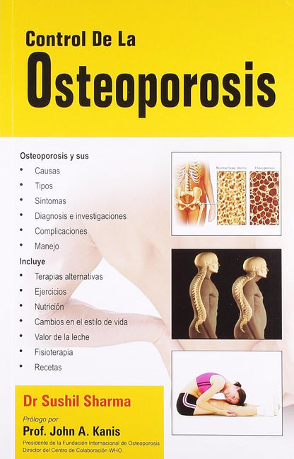 Control De La Osteoporosis (Spanish)