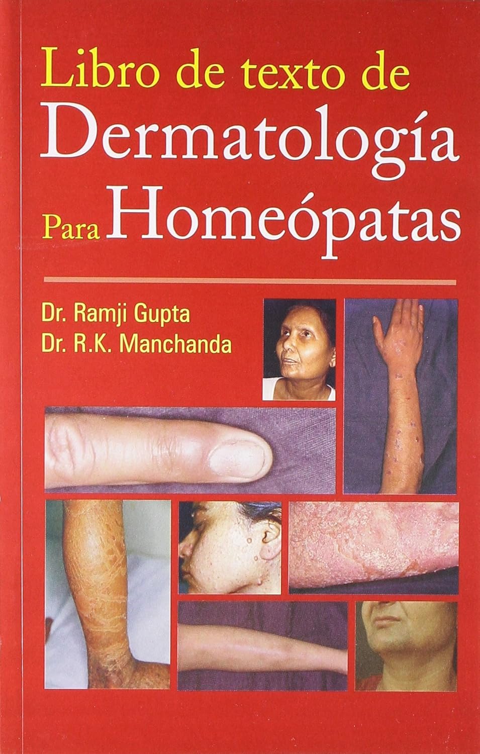 Libro de texto de Dermatología Para Homeópatas (Spanish)