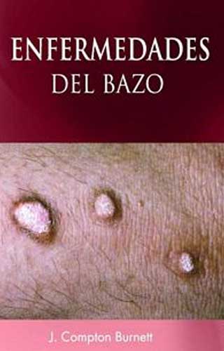 Enfermedades Del Bazo (Spanish)