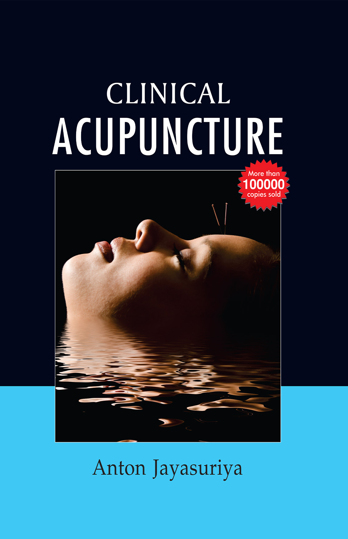 Clinical Acupuncture With Chart