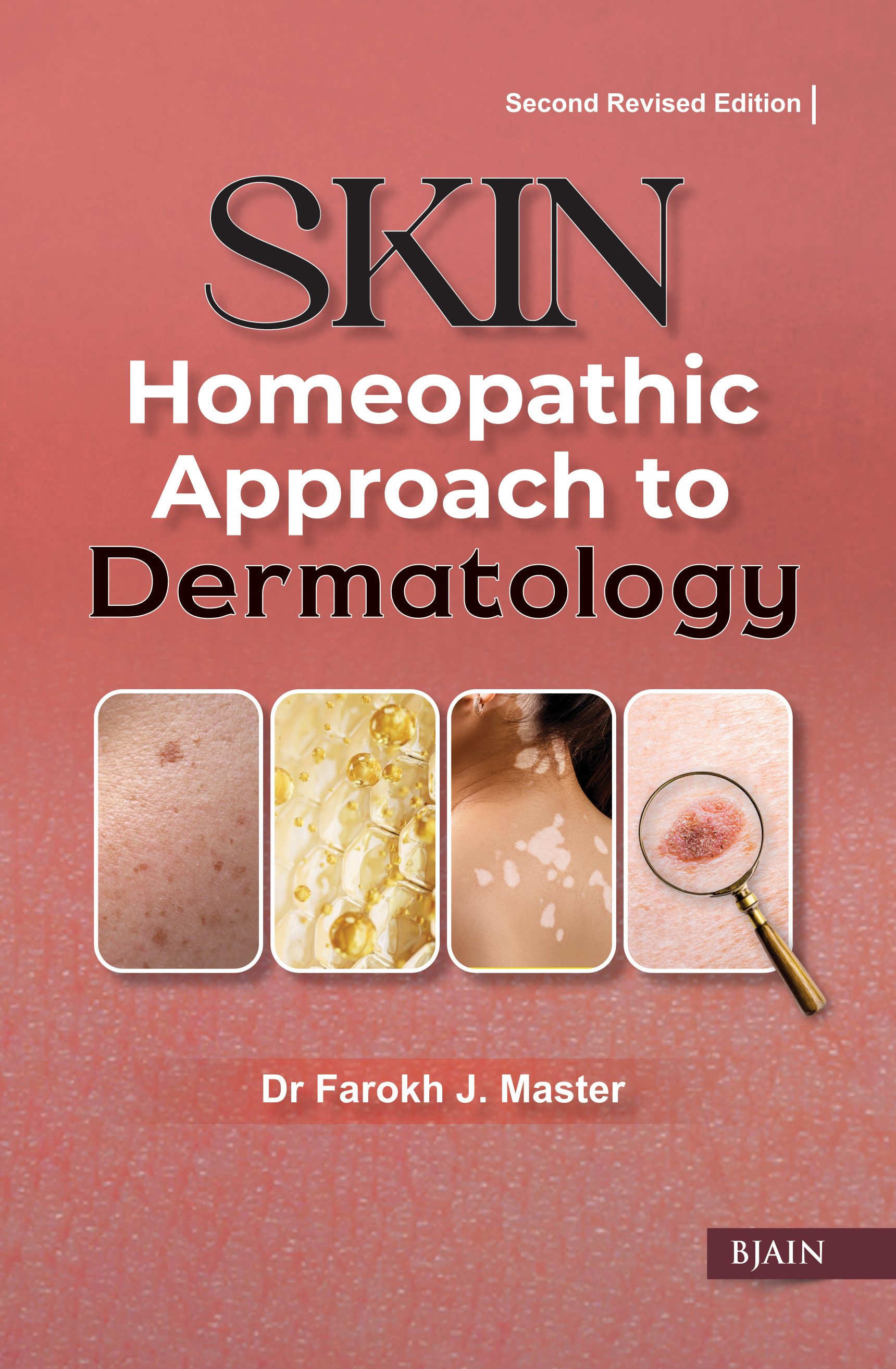 Skin: Homeopathic Approach To Dermatology